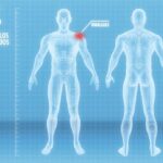 Animaciones interactivas para Doloforma
